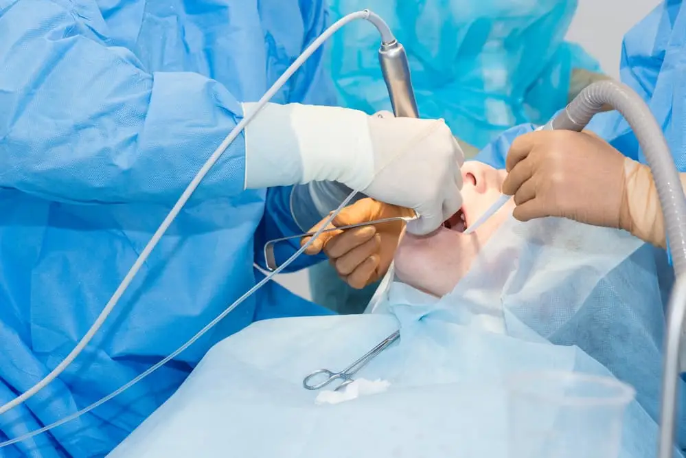 How IV Sedation Works