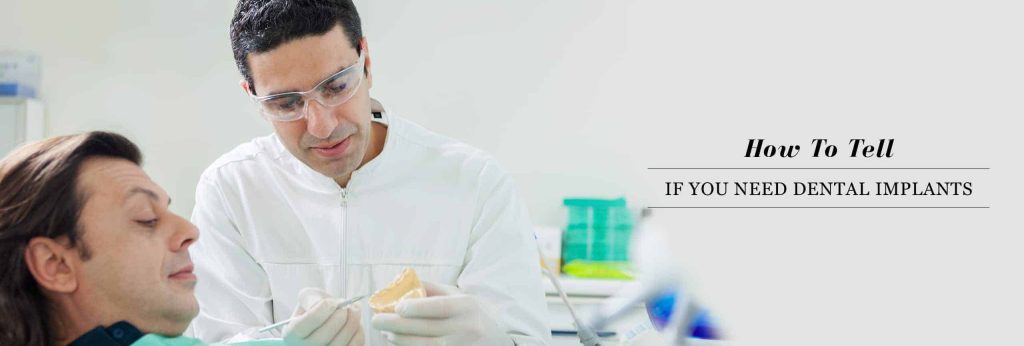 How to tell if you need dental implants