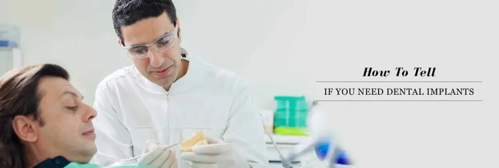 How to tell if you need dental implants