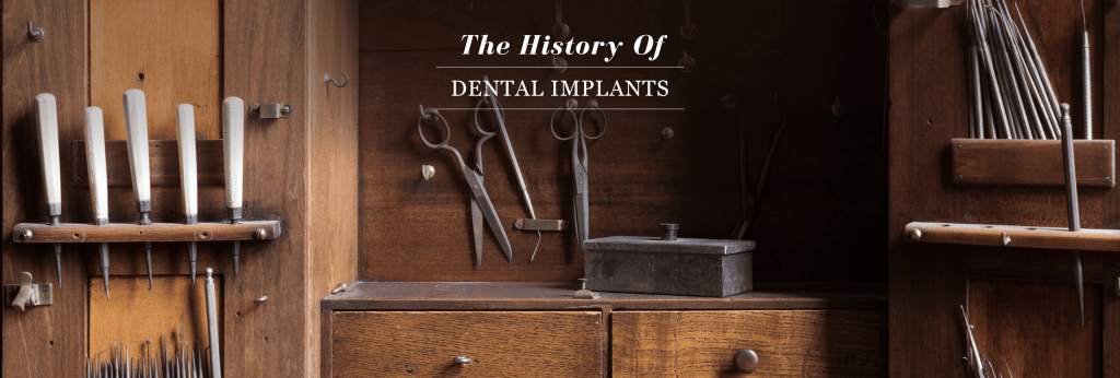 The History of Dental Implants