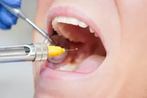 What Can Trigger Your Dental Fears?