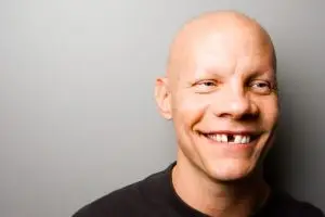 Dental Implants Fill in Gaps Left From Missing Teeth