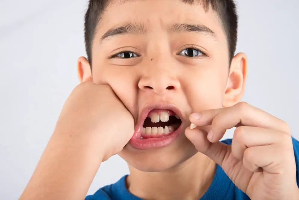 Can Children Get Dental Implants?