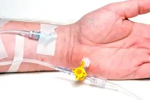 Benefits of IV Sedation