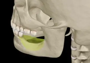 Bone Loss