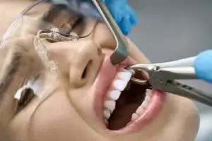 Dental Anxiety and Tooth Extractions
