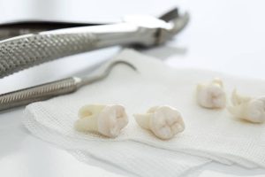 Dental Emergencies: Treatment That Can Save Teeth