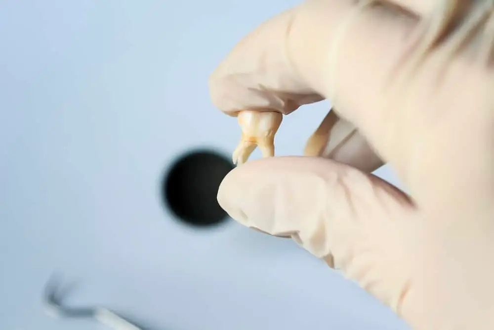 7 Ways to Prevent Tooth Loss