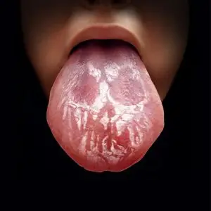 Other Health Concerns Revealed By The Tongue